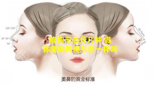 隆胸形态分几种 假体隆胸两侧形态一样吗